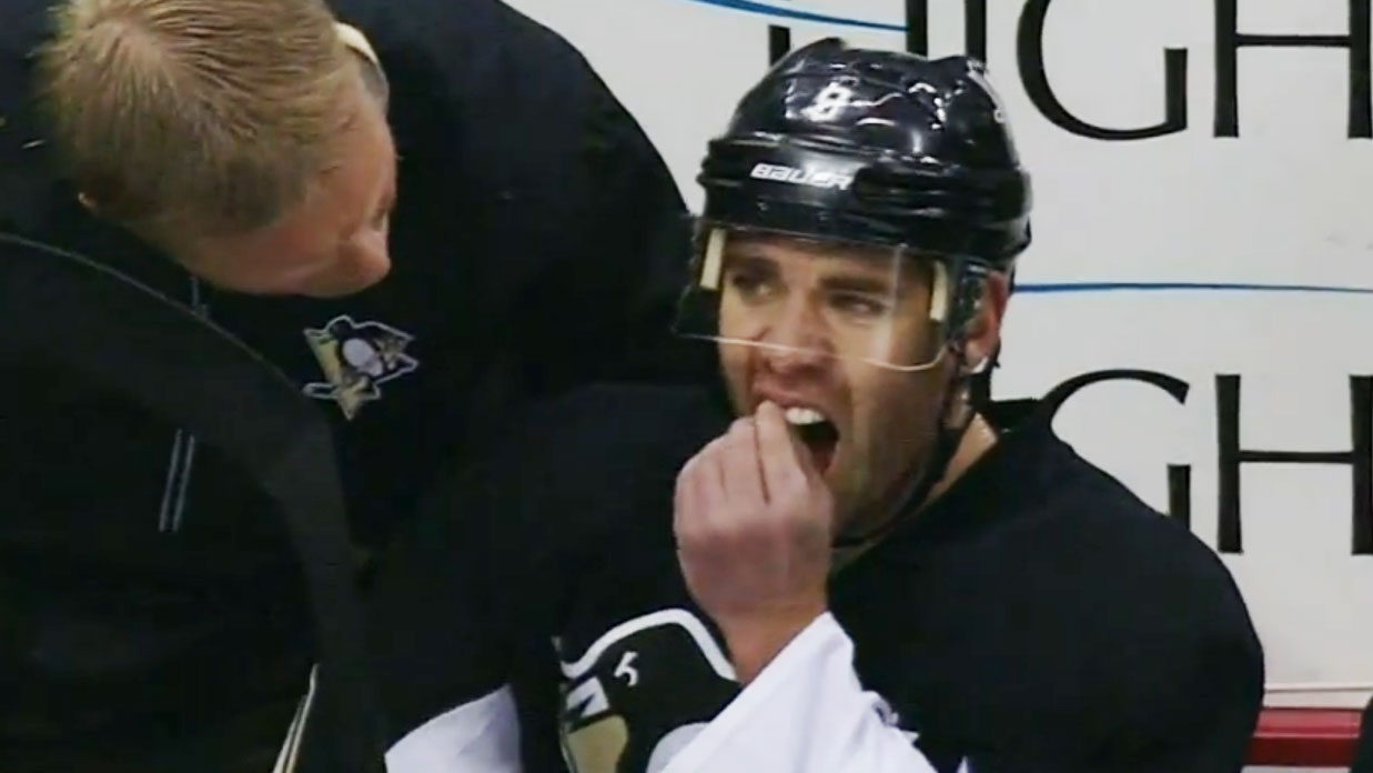 NHL star pulls his own tooth out while on the bench after taking