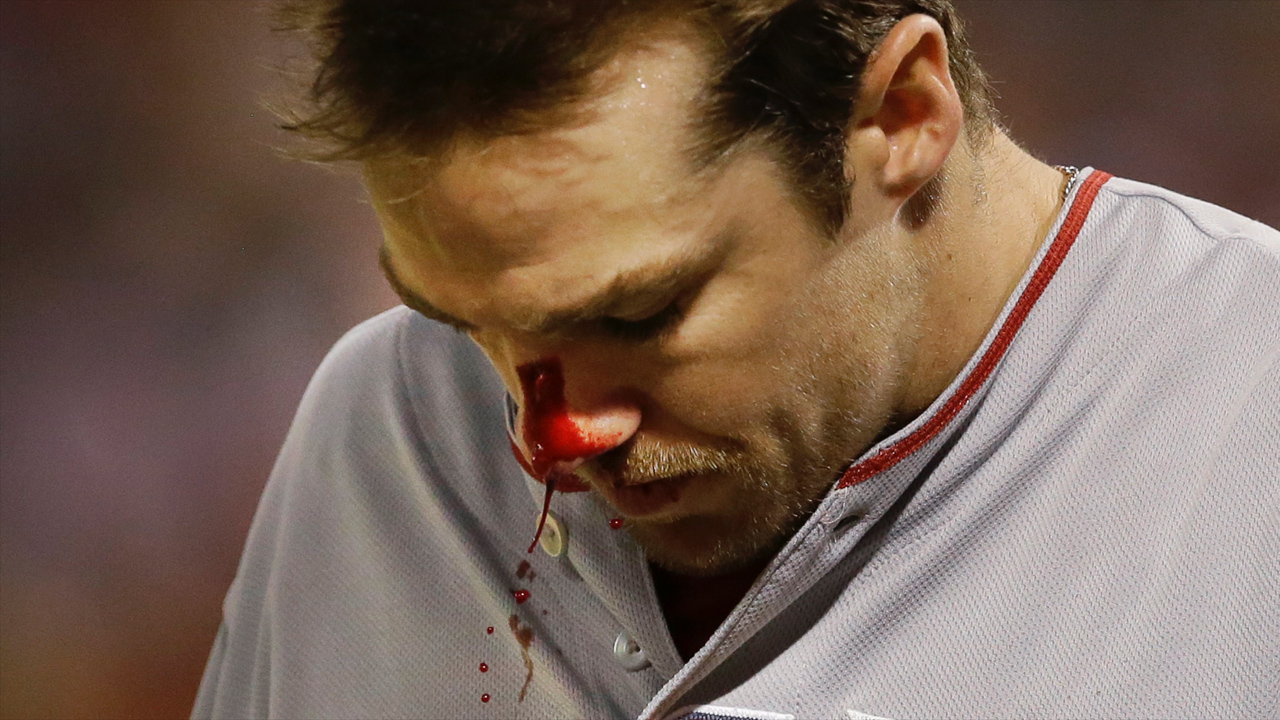 Fan struck by foul ball at White Sox-Nationals game, taken to hospital for  observation