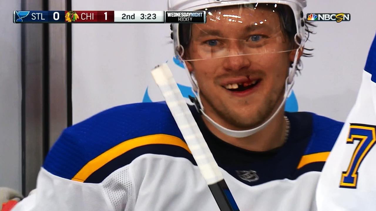 nhl player pulls out tooth