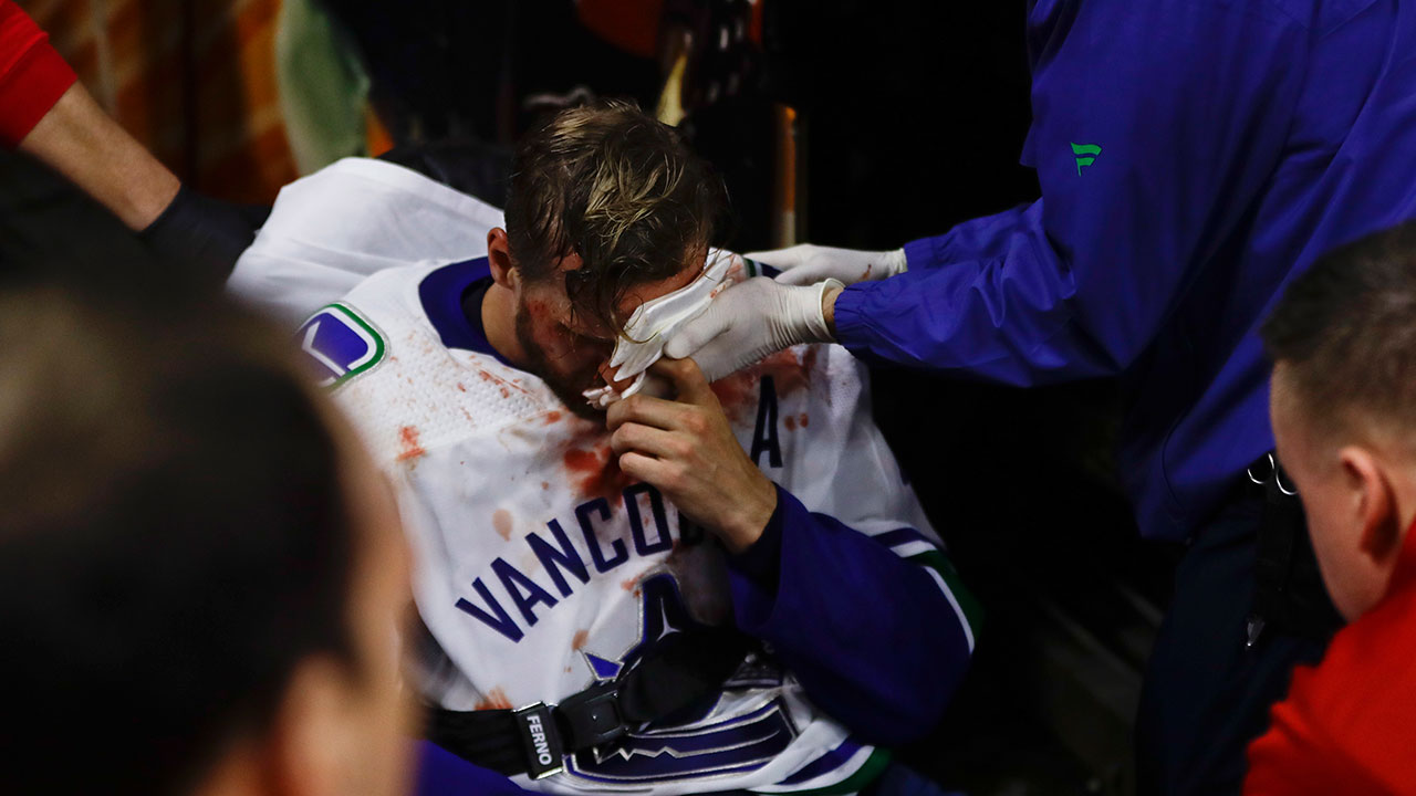Canucks' Edler out at least a week with concussion