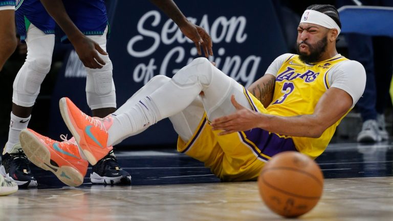 Los Angeles Lakers forward Anthony Davis (3) holds his leg after falling in the third quarter of an NBA basketball game with the Minnesota Timberwolves Friday, Dec. 17, 2021, in Minneapolis. The Timberwolves won 110-92. (Bruce Kluckhohn/AP)