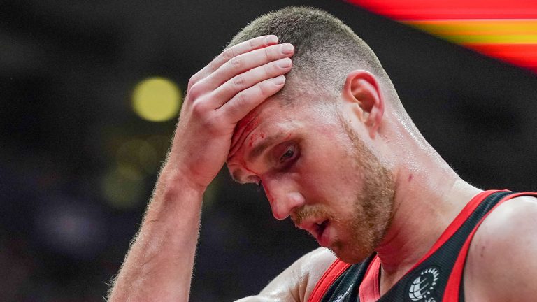 Toronto Raptors guard Svi Mykhailiuk (14) holds his forehead after being cut during first half NBA action in Toronto. (Evan Buhler/CP)