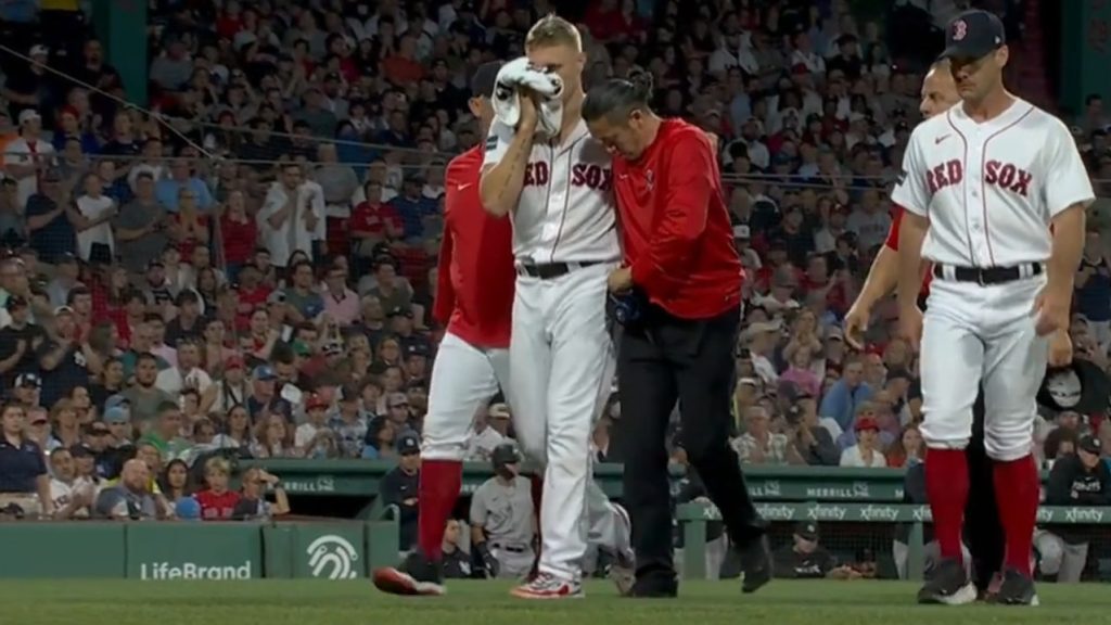 Red Sox pitcher Houck forced to leave game after taking line drive off face