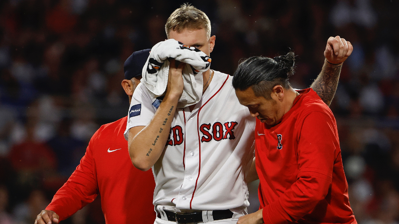 New Red Sox player removed from game after being hit in face with