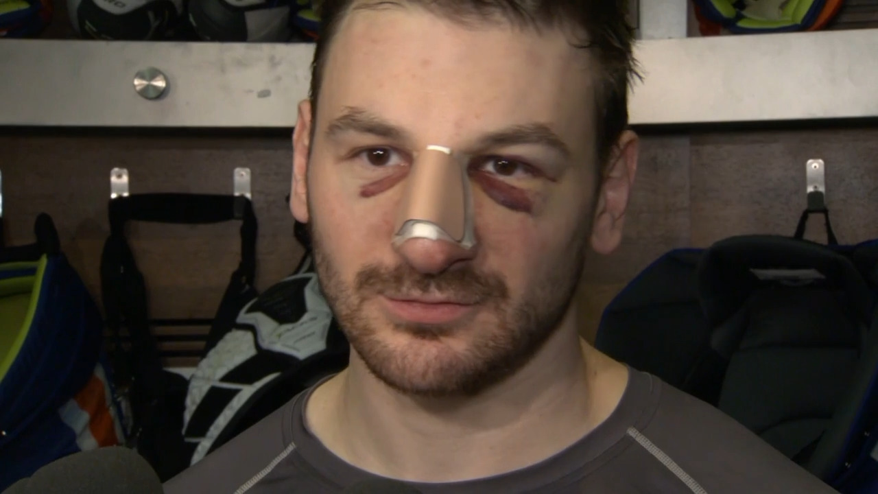 Oilers’ Hyman on history of broken noses: ‘This one is probably worse’