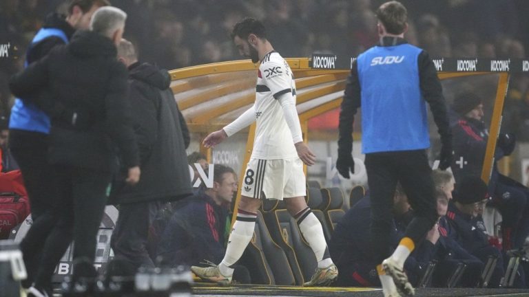 Manchester United's Bruno Fernandes heads down the tunnel after being sent off during the English Premier League soccer match between Wolverhampton Wanderers and Manchester United at the Molineux Stadium, Wolverhampton, England, Thursday, Dec. 26, 2024. (David Davies/PA/AP)